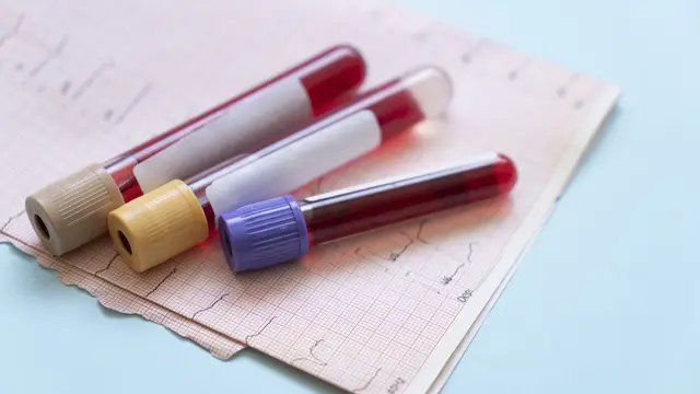 AIU imposes lengthy bans on four athletes for doping violations — image accompanying Canadian Running's report